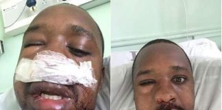 Bonface Mwangi beaten by the wife