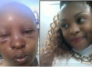 Otuoma wife’s Rozyane Beaten badly by MP Husband