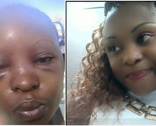 Otuoma wife’s Rozyane Beaten badly by MP Husband