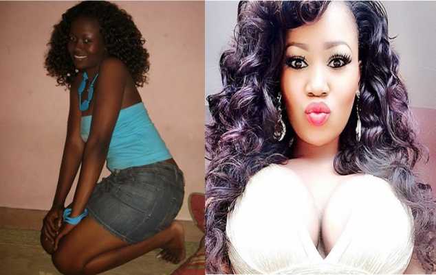 Vera Sidika before and after Bleaching