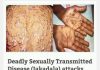 lethal Sexually transmitted disease called JAKADALLA spreads fast in Migori